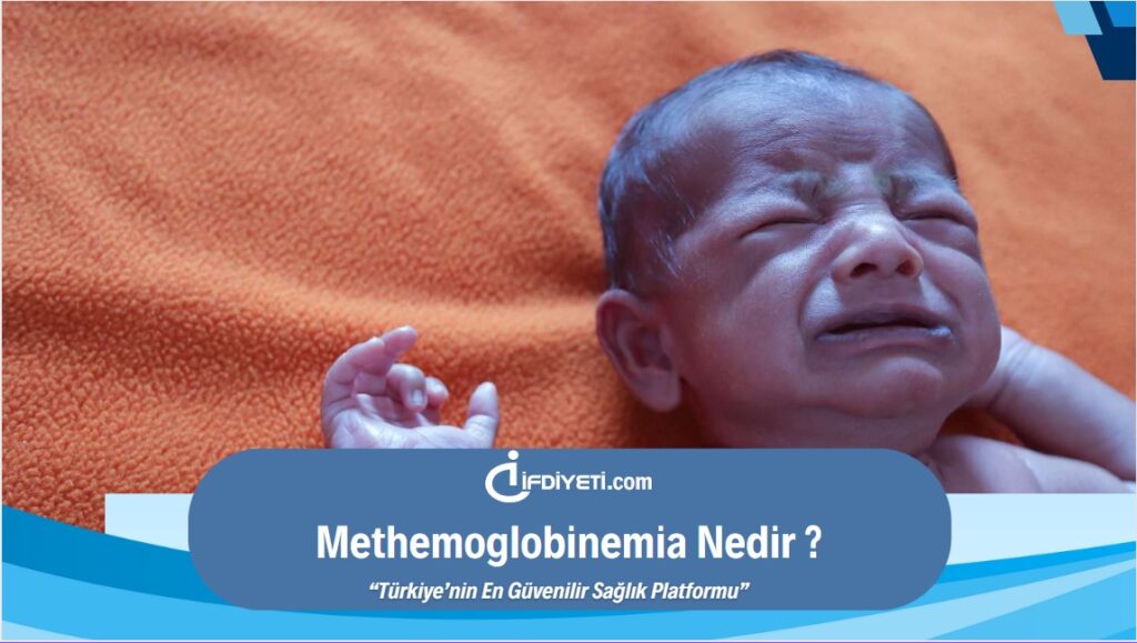 Methemoglobinemia Nedir ve Nasıl Oluşur?
